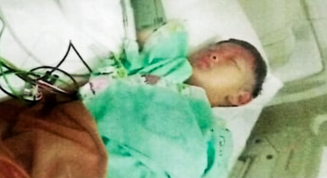 Menanti Uluran Tangan untuk Bilal Hilmi Nurdaffa